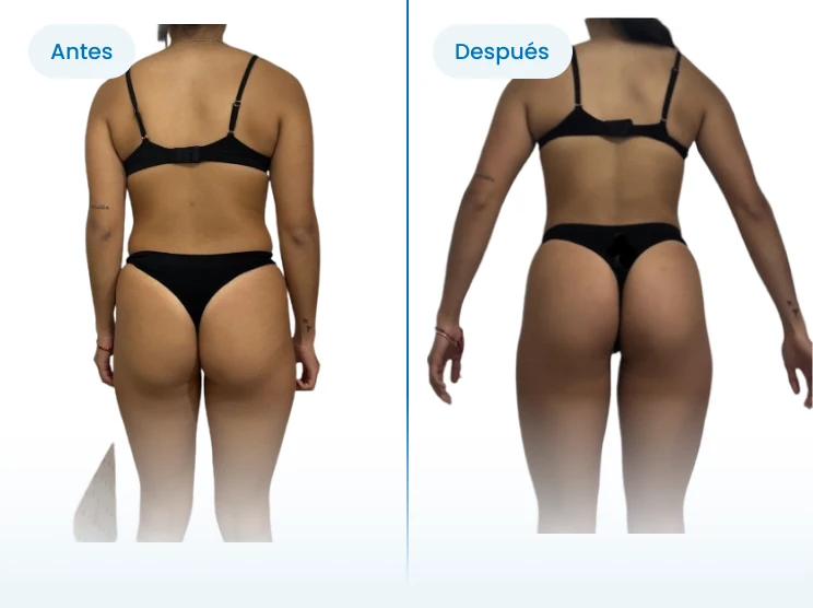 Cambio físico de espaldas: Emely