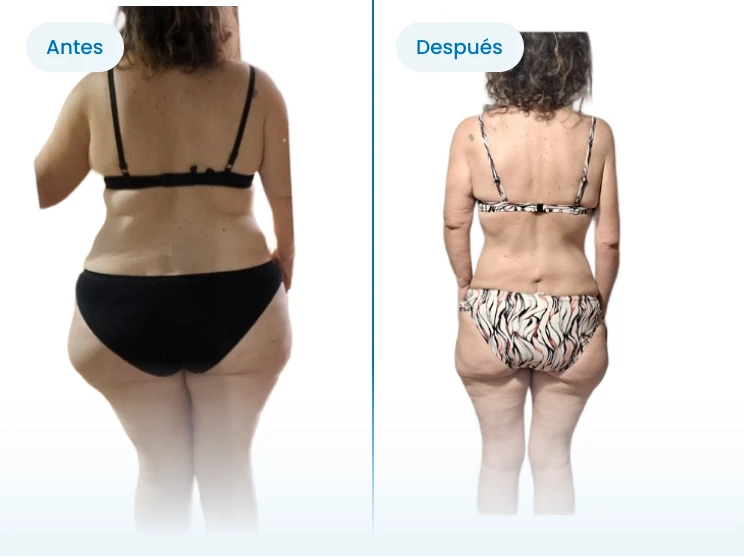 Cambio físico de espaldas: Pastora